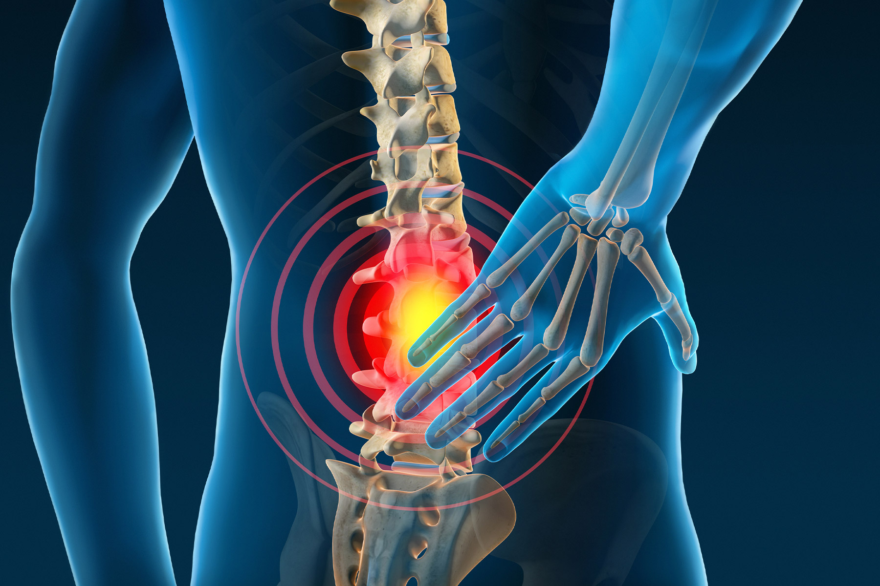 Is Lower Right Back Pain A Sign Of Colon Cancer